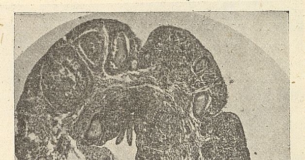 Ovario de Llaca (Marmosa elegans) en corte longitudinalFuente: Investigaciones zoológicas chilenas. Santiago: Edit. del Pacífico, Vol. 1 (1950: jul. - 1952: dic.) 131 p.Página 11 del fascículo 3 de marzo de 1951.