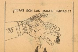 ¿Estas son las manos limpias?, 1983-1988