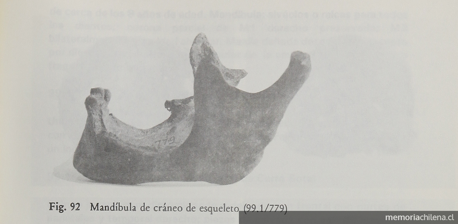 Vistas del cráneo de esqueleto 99.1/780 excavado en Cerro Sota.Viajes y arqueología en Chile austral. Ediciones de la Universidad de Magallanes, Punta Arenas. 1988.