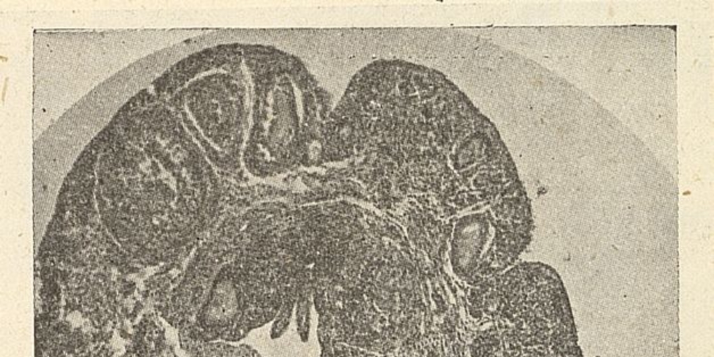 Ovario de Llaca (Marmosa elegans) en corte longitudinalFuente: Investigaciones zoológicas chilenas. Santiago: Edit. del Pacífico, Vol. 1 (1950: jul. - 1952: dic.) 131 p.Página 11 del fascículo 3 de marzo de 1951.
