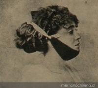 Ortopedia casera para quitar la doble barba, 1911