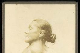 Enfermo de bocio, ca. 1900