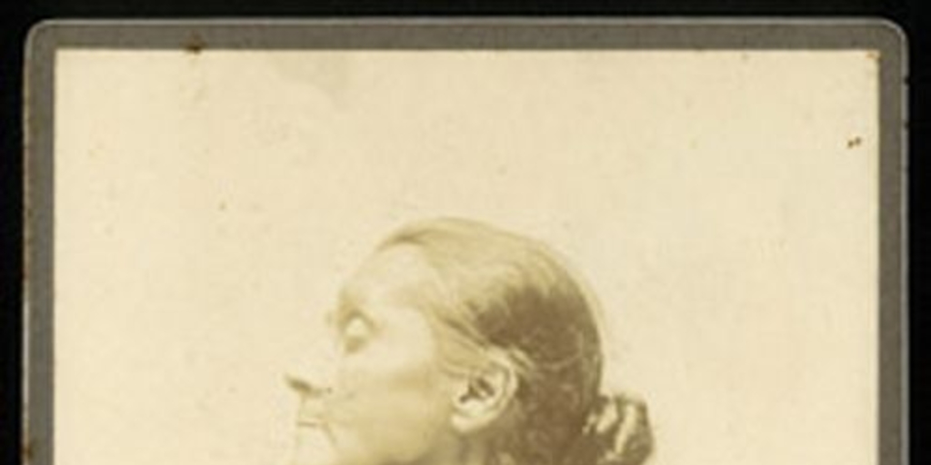 Enfermo de bocio, ca. 1900